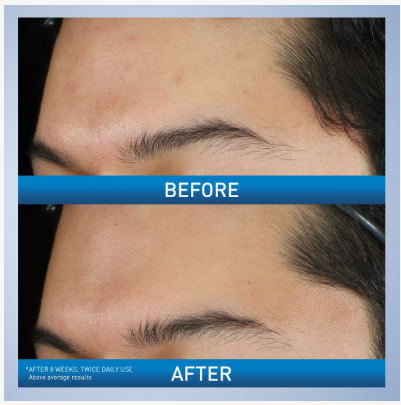 CeraVe | Foaming Cream Wash | Crema Espumosa para Acné